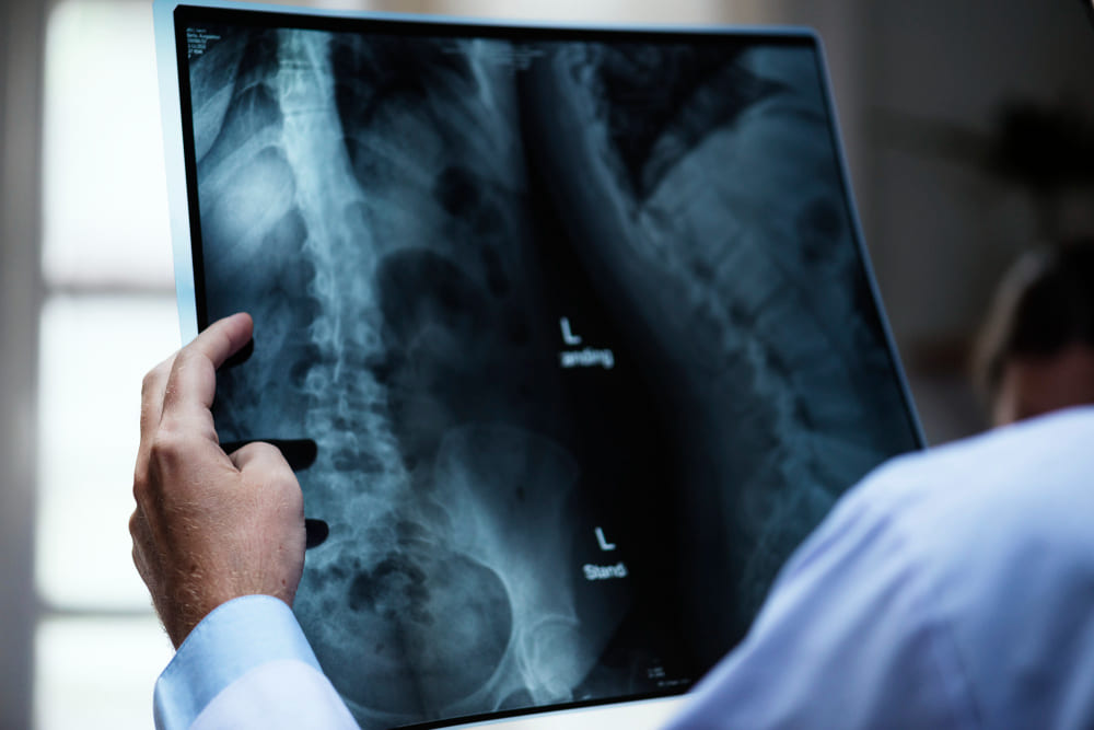 Spinal Surgeries After a Car Accident